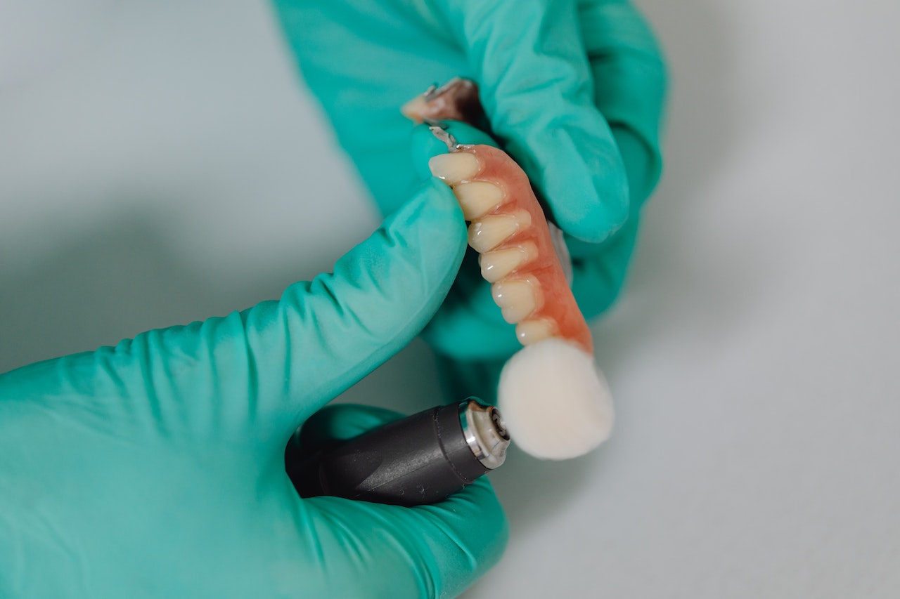 Implanty zębowe – jakie są zalety tego rozwiązania?